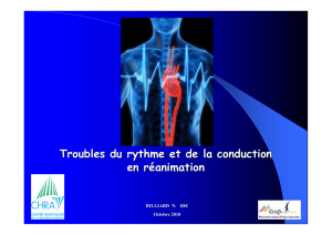 Troubles du rythme e..