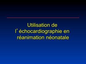 Echocardiographie en réanimation néonatale