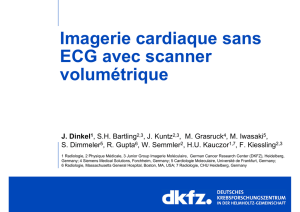 Imagerie cardiaque sans ECG avec scanner volumétrique