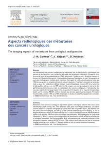 Aspects radiologiques des métastases des cancers