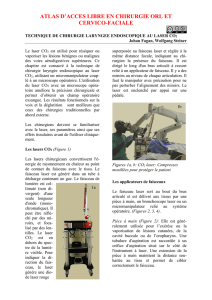 Transoral CO2 laser microsurgery (TLM) for cancer - Vula