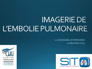 imagerie de l`embolie pulmonaire