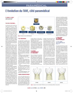 L`évolution du TAVI, côté paramédical
