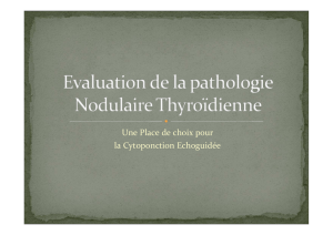 clinique de la pathologie nodulaire thyroidienne