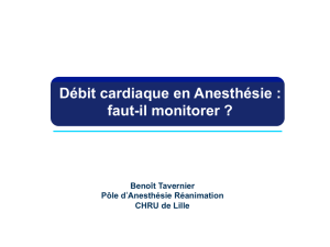 Débit cardiaque en Anesthésie : faut-il monitorer
