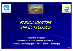 endocardites infectieuses