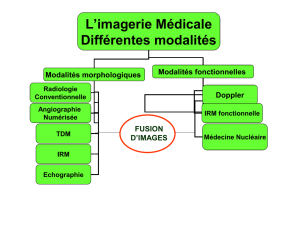 Imagerie medicale