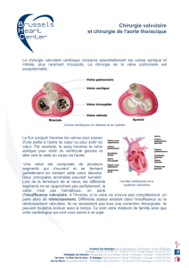 Chirurgie valvulaire et chirurgie de l`aorte thoracique