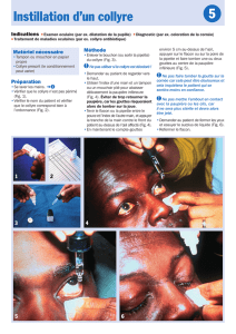 Instillation d`un collyre 5 - Community Eye Health Journal