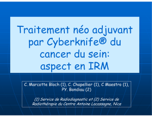 Traitement néo adjuvant par Cyberknife® du cancer du sein: aspect