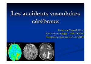 2016 - Accident vasculaire cerebral