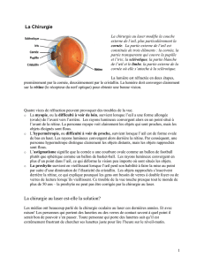 Laser eye surgery notes