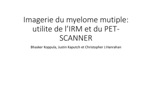 Imagerie du myelome mutiple: utilite de l`IRM et du PET