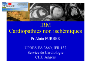 IRM Cardiopathies A Furber DIU 2016