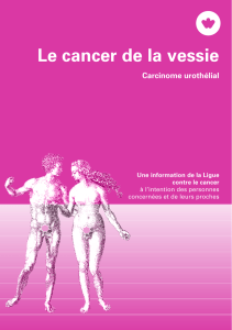 Le cancer de la vessie – Un guide de la Ligue contre le