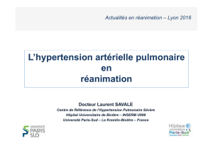 L`hypertension artérielle pulmonaire en réanimation - JIVD
