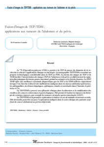 Fusion d`images de TEP/TDM : applications aux tumeurs de l