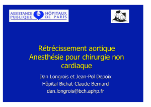 Rétrécissement aortique Anesthésie pour chirurgie non cardiaque