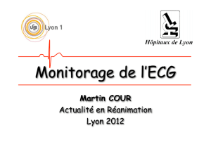 monitorage de l`ECG - JIVD