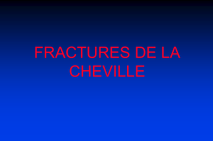 9.Cheville Fractures