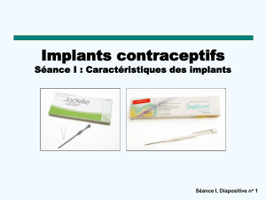 Séance I: Caractéristiques des implants