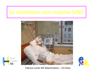 La ventilation non invasive (VNI)