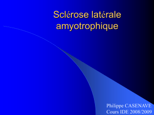 Sclerose laterale amyotrophique