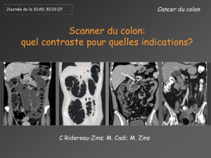 Scanner du colon : quel contraste pour quelles indications