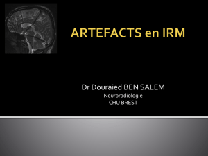 ARTEFACTS en IRM