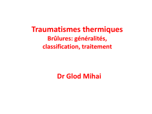 Traumatismes thermiques. Brûlures: généralités, classification