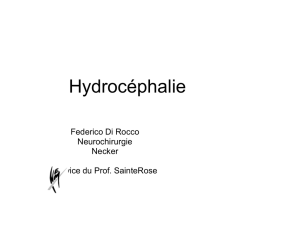 Hydrocephalie_light