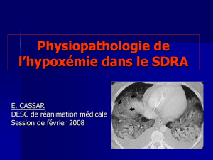 Physiopathologie de l`hypoxémie dans le SDRA