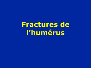 Fractures de l` humérus