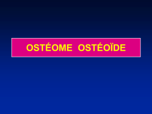 ostéome ostéoïde