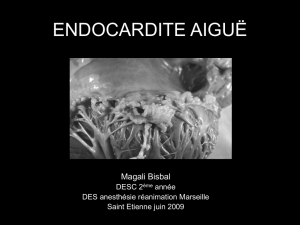 Endocardite aiguë - DESC Réanimation Médicale