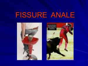 FISSURE ANALE