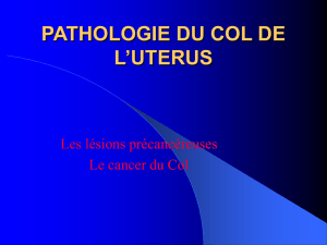 PATHOLOGIE DU COL DE L UTERUS_Dr Rognon