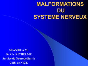 malformations du systeme nerveux