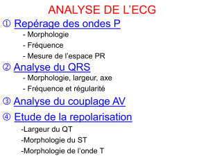 Analyse de l`ECG - Le site de l`UHCD du CHRA