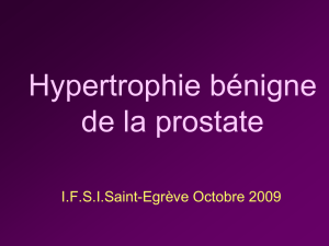 Hypertrophie de la prostate