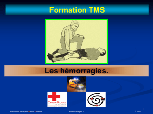 Formation TMS Les hémorragies.