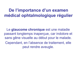 depistage_glaucome_chronique_dépistage glaucome