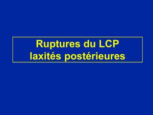 2-Ligament croise posterieur LCP