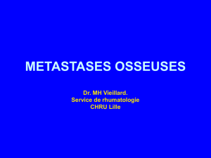 metastases osseuses