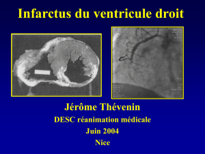 j. thevenin - DESC Réanimation Médicale