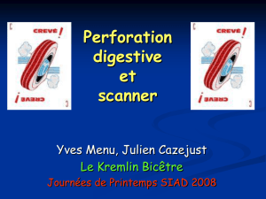 Scanner des perforations digestives spontanées