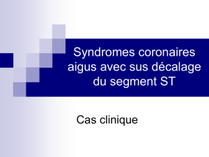 Syndromes coronaires aigüs sans sus décalage du ST