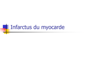 Infarctus du myocarde