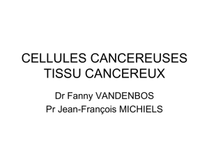cellules cancereuses tissu cancereux