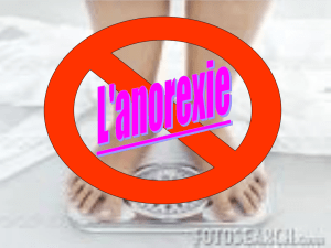 L `anorexie